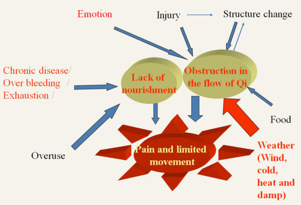 Causes of pain graphic