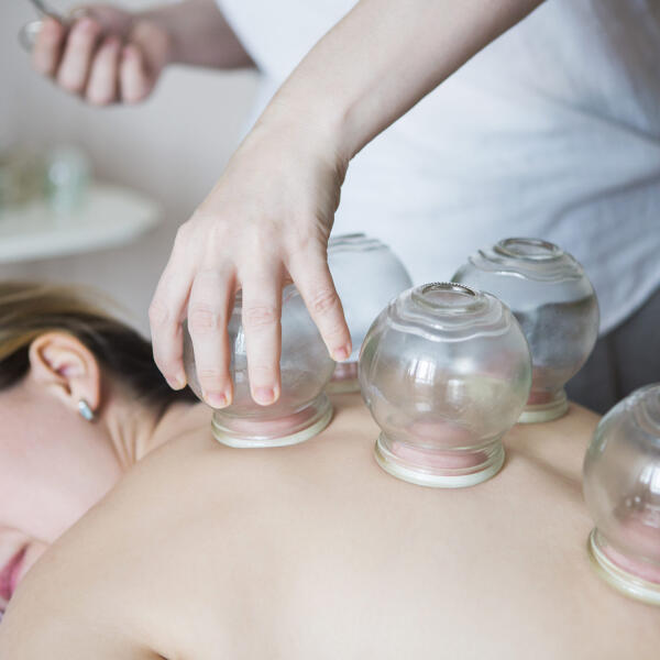 Cupping-and-moxibustion